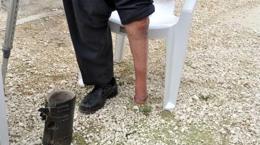 Hasene Vekfı&rsquo;ndan T&uuml;rk Ve Suriyelilere Protez Desteği