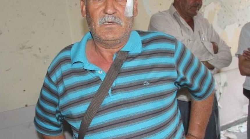 (&ouml;zel Haber) Bombalı Saldırıda Yaralanan Eski Başkan Yaşadıklarını Anlattı