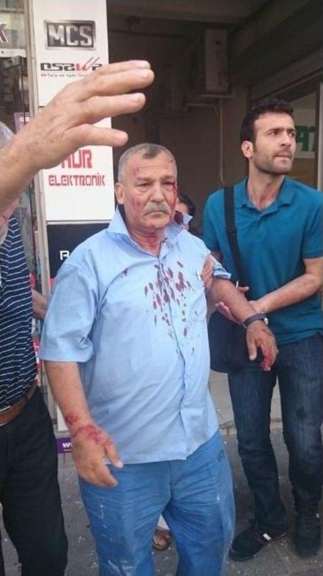 (&ouml;zel Haber) Bombalı Saldırıda Yaralanan Eski Başkan Yaşadıklarını Anlattı 3
