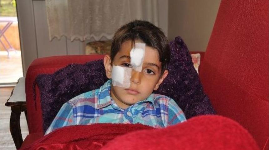 K&ouml;pek &Ccedil;ocuğun Y&uuml;z&uuml;n&uuml; Isırdı