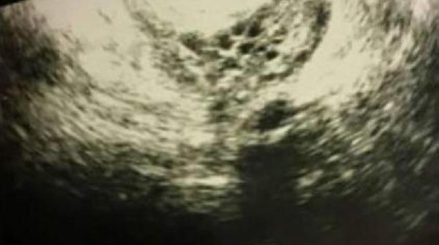 İzmirli &Ccedil;ift, Ikiz Bebeklerin Ardından Bu Kez Altız Bebek Beklemeye Başladı