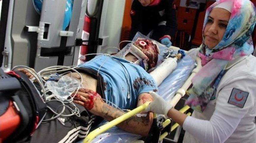 Av T&uuml;feği İle Başından Vurulan 1 Kişi Ağır Yaralandı