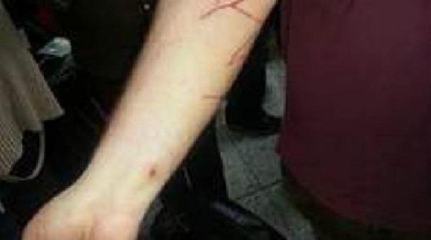 Kedi, Abd&rsquo;Li Yolcuyu Hastanelik Etti