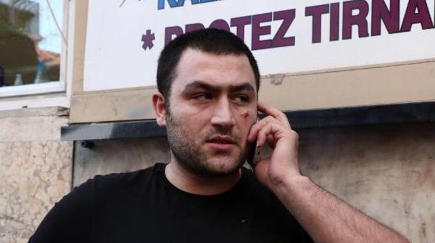 Barber Beaten Up For Refusing To Shake Akp Deputy&rsquo;S Hand In Istanbul