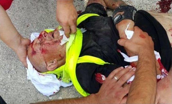 Muğla’da Otomobilin Çarptığı Fransız Bisikletçi Ağır Yaralandı G2