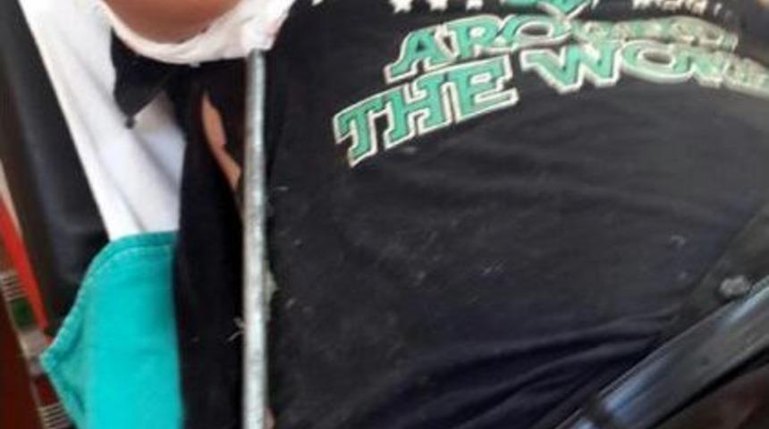 Oto Yıkama Tabancası V&uuml;cuduna Saplandı