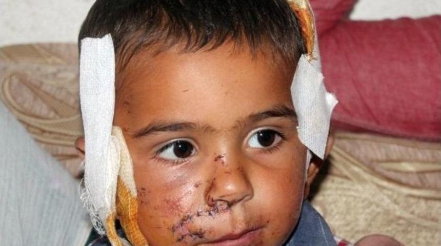 K&ouml;peğin Isırdığı &Ccedil;ocuk &Ouml;l&uuml;mden D&ouml;nd&uuml;