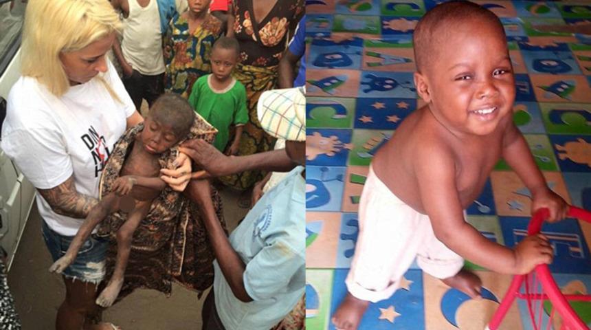 İyilik kazandı! Ailesinin &ouml;l&uuml;me terk ettiği k&uuml;&ccedil;&uuml;k &ccedil;ocuğun 2 ay sonraki g&ouml;r&uuml;nt&uuml;s&uuml;