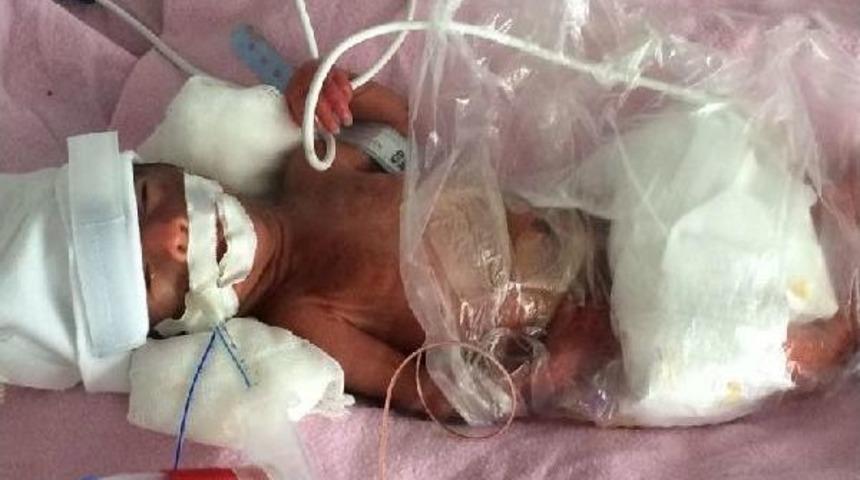 670 Gram Doğan Bebek Helikopterle Ankara&rsquo;Ya Sevk Edildi