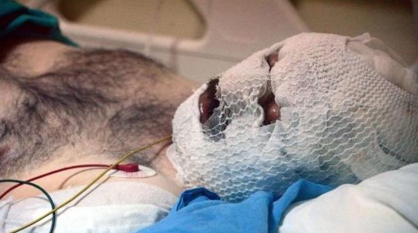 Erzurum'da Hdp Mitingi &Ouml;ncesi Olaylar &Ccedil;ıktı (6)