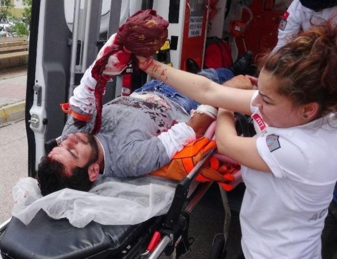 Alkoll&uuml; Arkadaşlar Birbirini Yaraladı