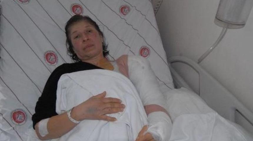 İki G&ouml;stericinin Kolunu Kıran Toma'daki Polislere, Soruşturma Izni &Ccedil;ıkmadı