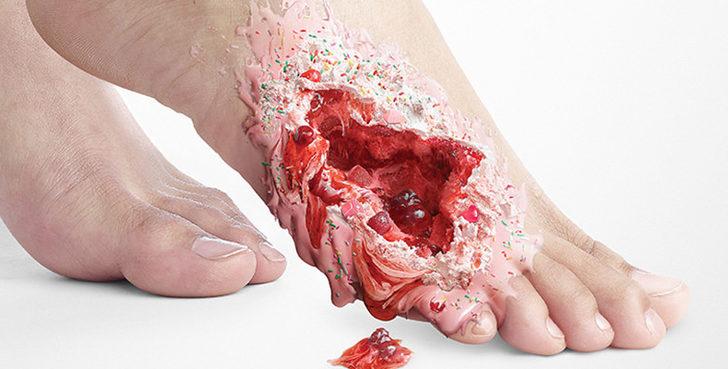  Tatlı &ouml;ld&uuml;r&uuml;r!