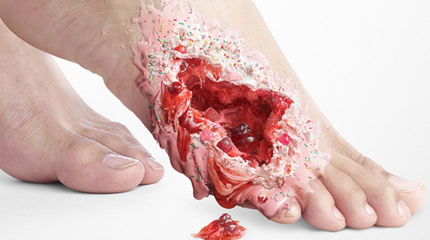  Tatlı &ouml;ld&uuml;r&uuml;r!