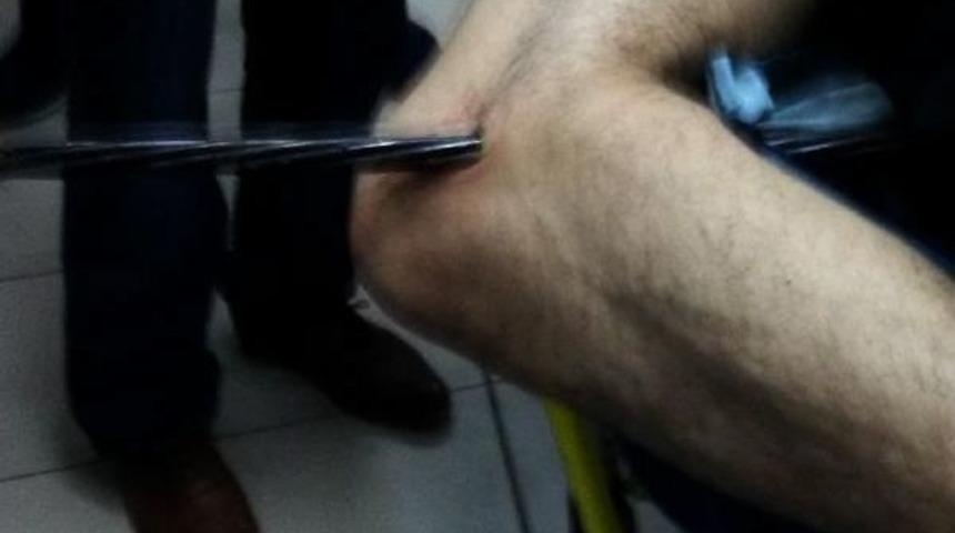 Bacağına Bacağına Saplanan, 1 Metrelik &Ccedil;elik Halatla Hastaneye Getirildi