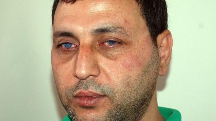 29 Yaşından Sonra D&uuml;nyası Karardı