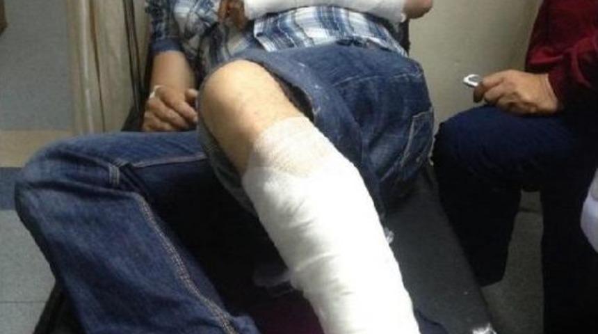 Polisten Ka&ccedil;mak I&ccedil;in Balkondan Atlayınca, Sol Kolu Ve Bacağını Kırdı