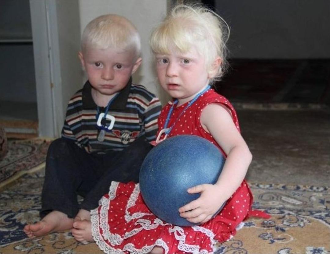 (&ouml;zel) 2 Yaşındaki Suriyeli İkizlerin Kararan D&uuml;nyası Aydınlığı Bekliyor