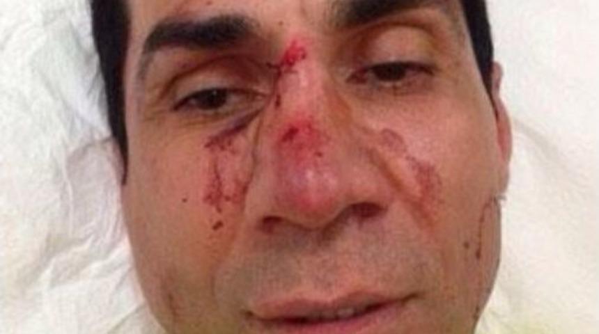 Belediye Meclis &Uuml;yesi, 3 Kişinin Saldırısına Uğradı