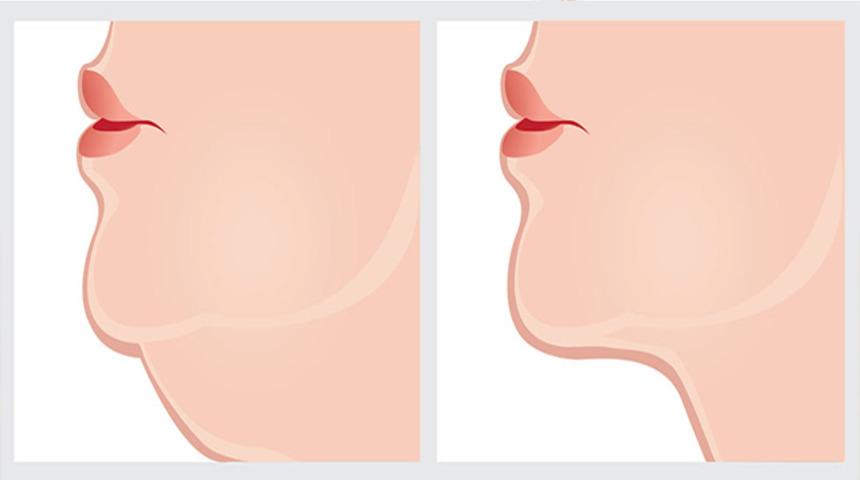 Evde yapacağınız maskeyle 'gıdı'nızı yok edin!