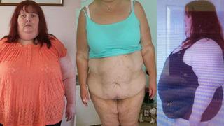 196 kilodan 78 kiloya düştü ama çok pişman!