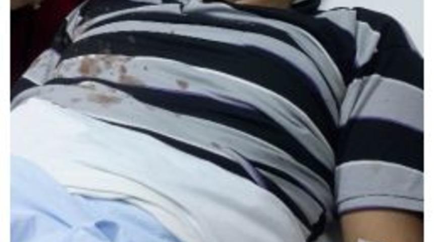 D&uuml;ğ&uuml;nde Maganda Kurşunu Hastanelik Etti