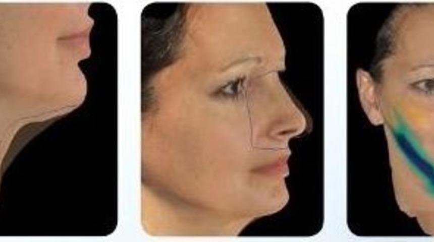 Estetikte Yeni Trend: "y&uuml;z Sim&uuml;lasyonu"