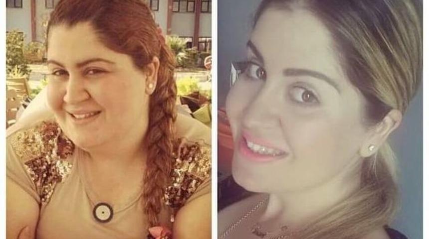 (&ouml;zel Haber) İzmirli Sinem T&uuml;p Mide Ameliyatıyla 55 Kilo Verdi