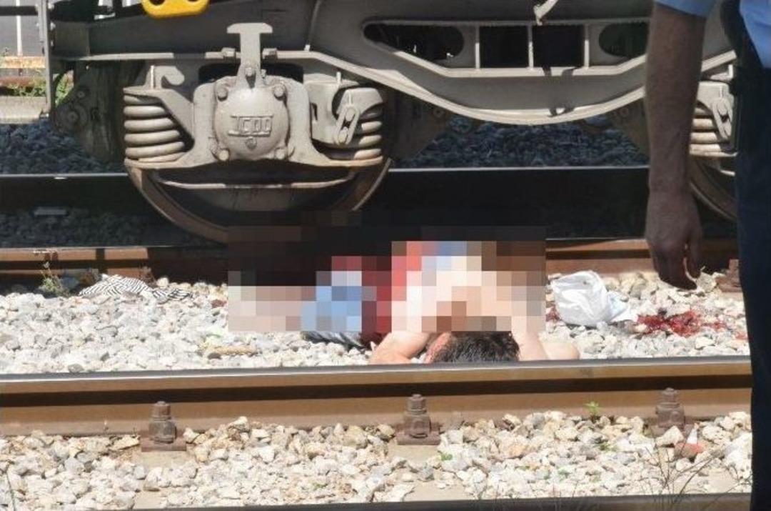 &Ouml;lmek İstedi Bacağından Oldu