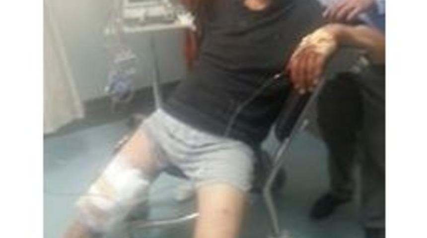 Ayının Saldırısına Uğradı