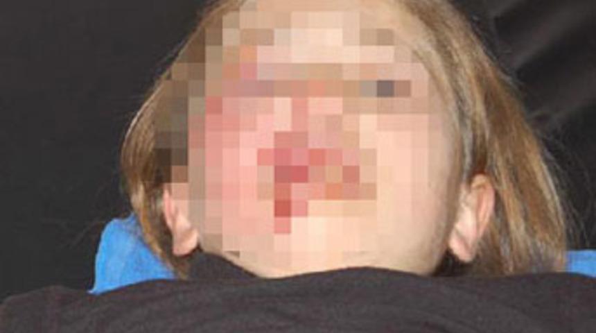 Yemeği ge&ccedil; yapan kızını balkondan attı