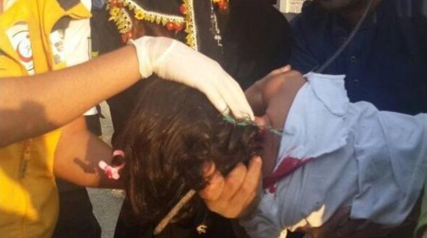 Balkondan D&uuml;şen &Ccedil;ocuğa İnşaat Demiri Saplandı