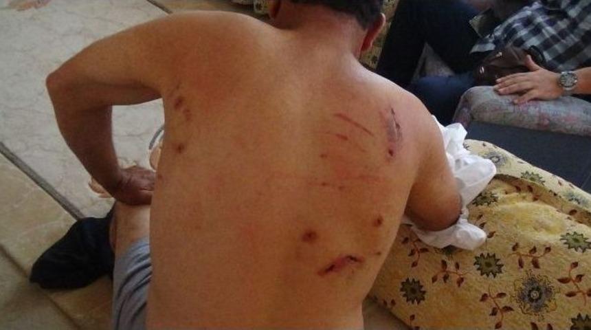 Ayı Saldırısı Bu Hale Getirdi