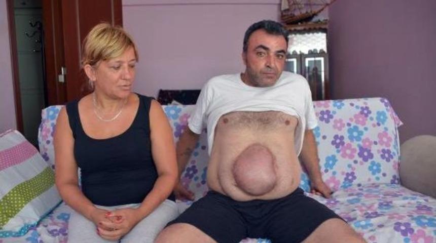 Apandisit Ameliyatında Ihmal Iddiasıyla Su&ccedil; Duyurusu