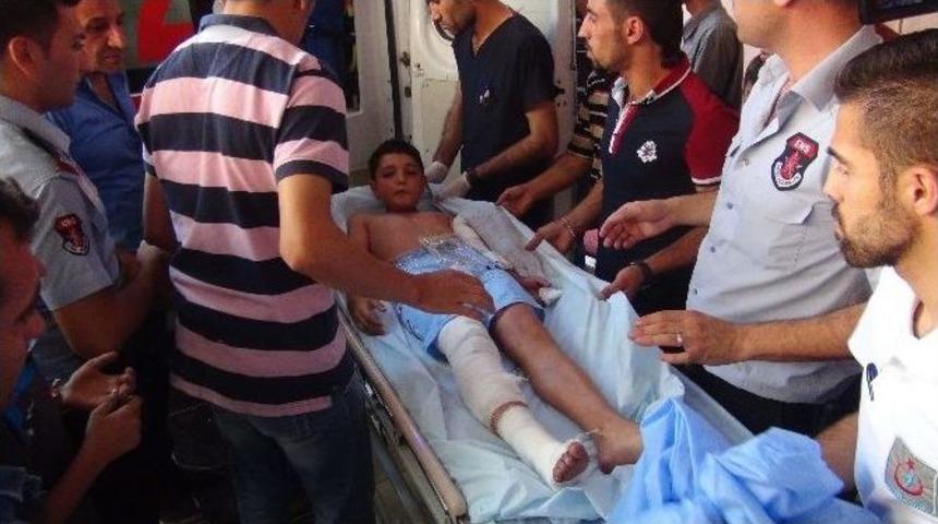 Buldukları Cisim Ellerinde Patlayan 2 &Ccedil;ocuk Yaralandı