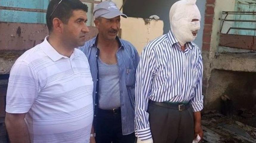 &Ccedil;orum&rsquo;da Yangın: 1 Yaralı