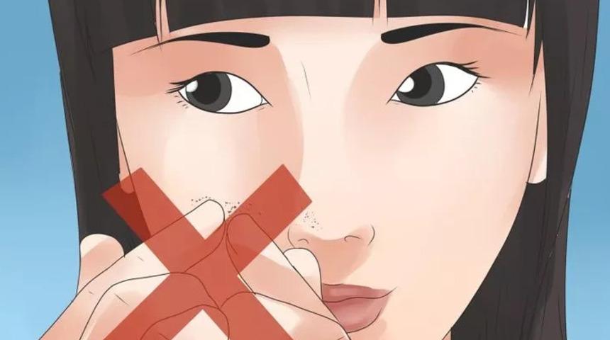 Siyah Noktalardan Nasıl Kurtulursunuz?