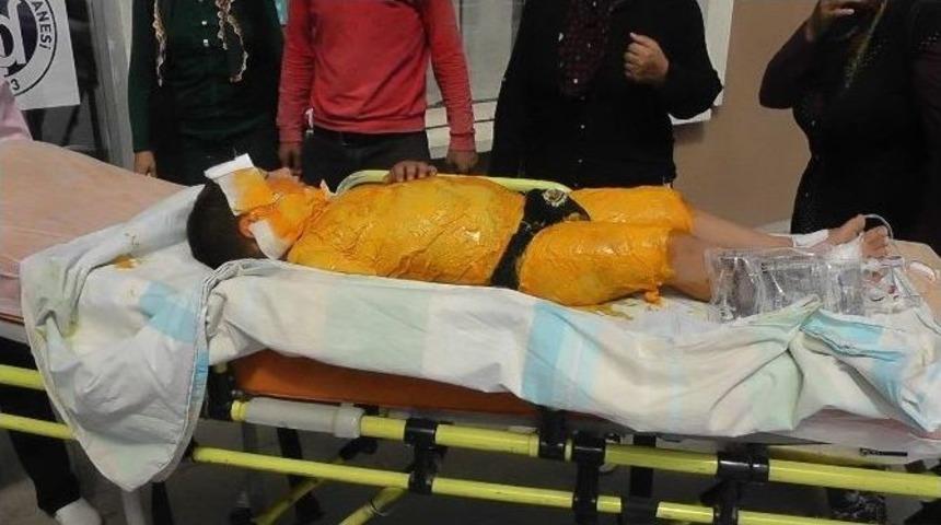 &Uuml;zerine Kaynar Su D&ouml;k&uuml;len &Ccedil;ocuk Haşlandı