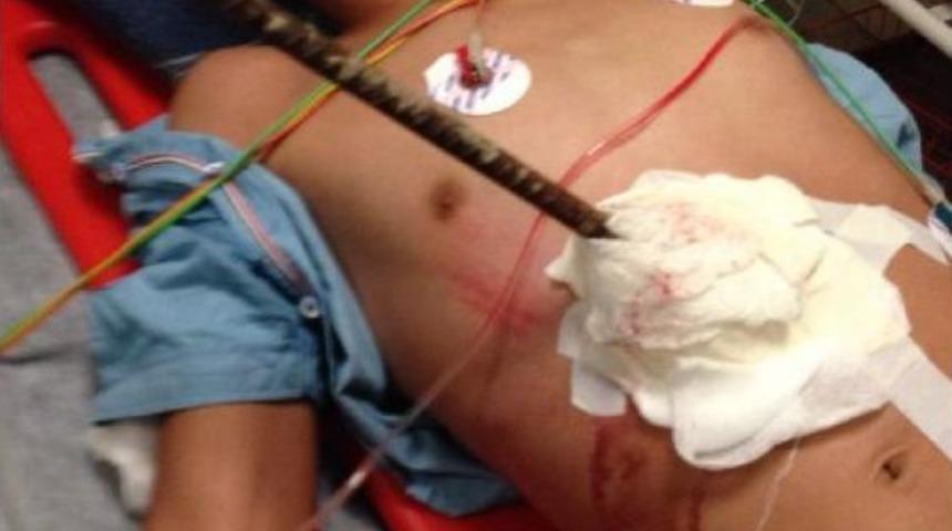 Karnına Saplanan 2 Metrelik Demir &Ccedil;ubuk Belinden &Ccedil;ıktı