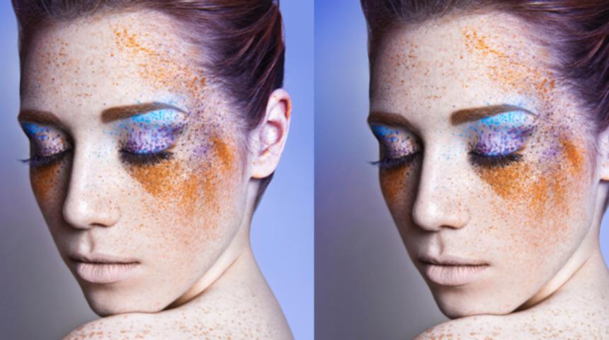 Y&uuml;z &ccedil;illeri nasıl azaltılır? 