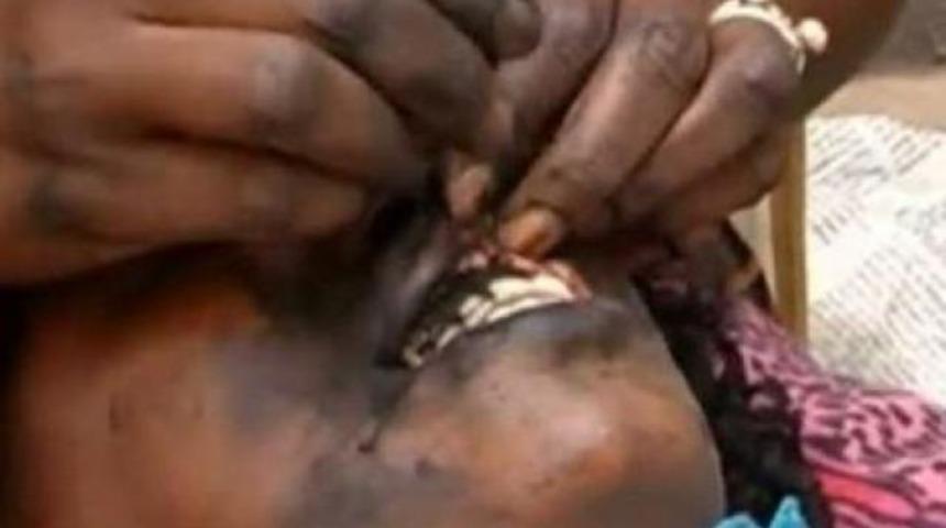 G&uuml;zellik uğruna &ccedil;ekilen eziyet