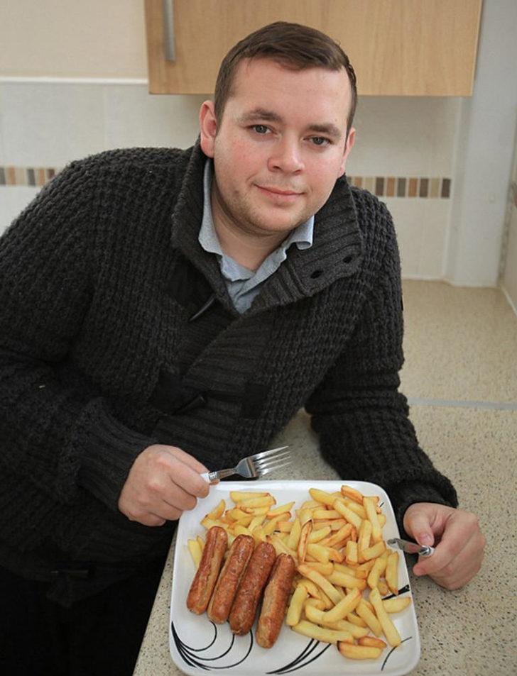 24 yıldır sadece sosis ve patates ile besleniyor G2