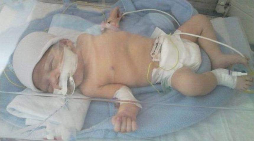 Minik Zehra Ameliyat Olamadan &Ouml;ld&uuml;