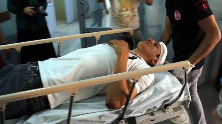 Başına Gaz Fişeği Isabet Eden &Ccedil;ocuk Ağır Yaralandı