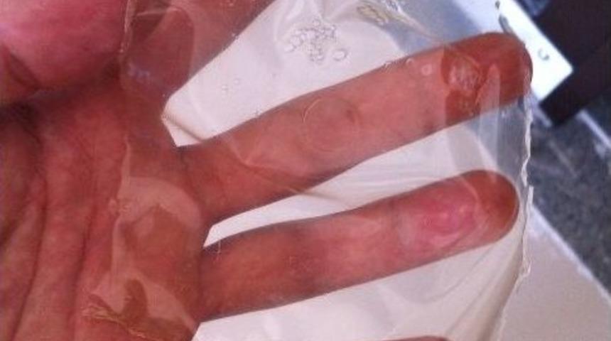 Bitkisel K&ouml;kenli Yenilebilir Film