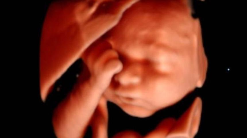 Bu kareyi yakalamak çok zor