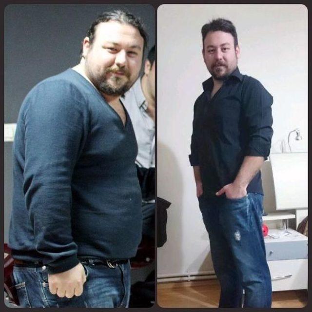 T&uuml;p Mide Y&ouml;ntemiyle 48 Kilo Verdi 1