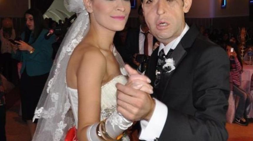 Y&uuml;z Nakli Olan Recep Sert, Baba Olmaya Hazırlanıyor