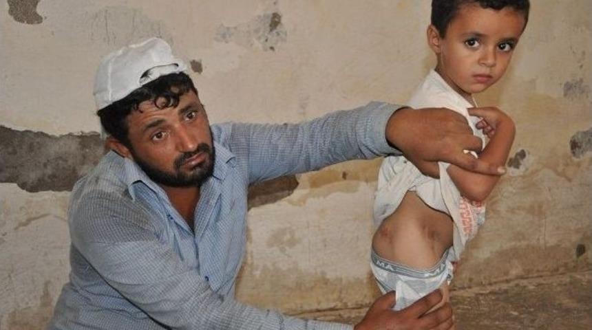 Suriye&rsquo;de Vurulan Baba Oğul T&uuml;rkiye&rsquo;de Hayata Tutundu