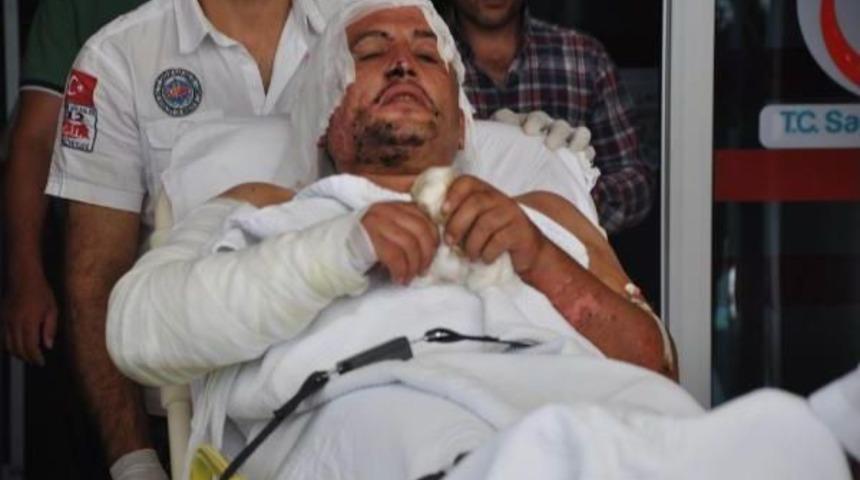 &Uuml;zerine Zift D&ouml;k&uuml;len Iş&ccedil;i Ağır Yaralandı